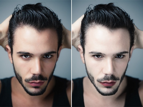 Бледность Бледность